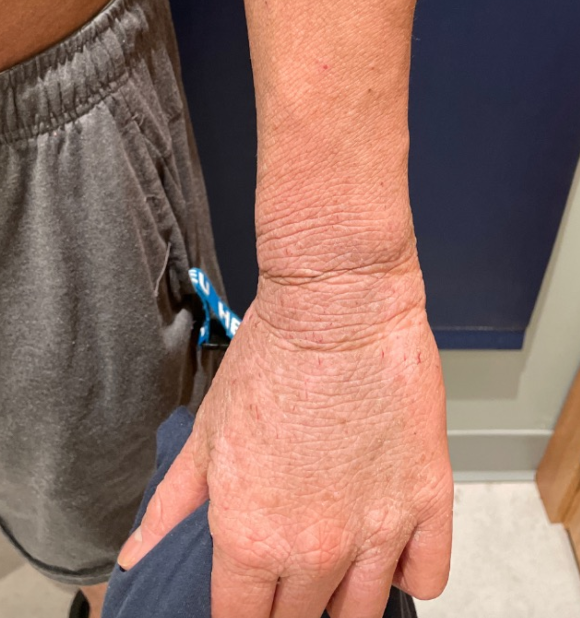 L arm/ hand